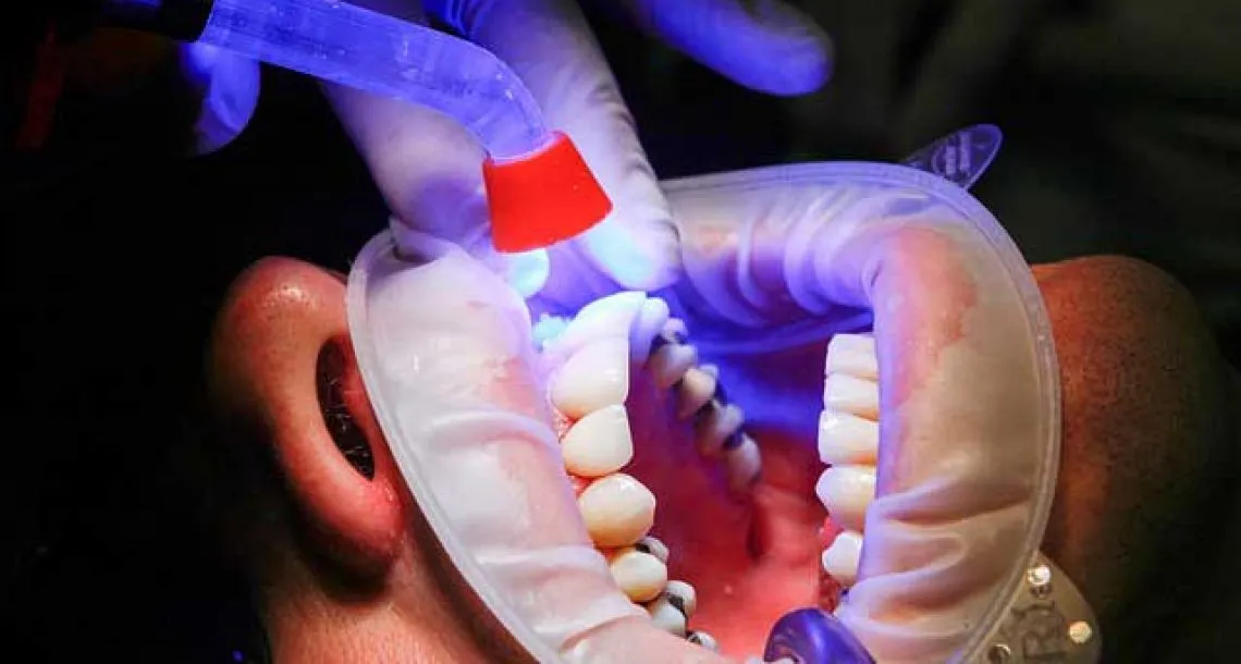 מומחה בשיקום הפה בירושלים